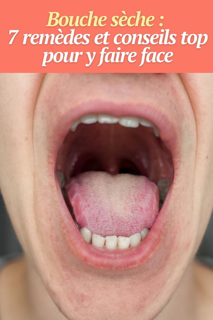 remède naturel goût amer bouche