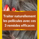 Remède naturel pellicules cheveux