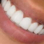 Avantages prothèse dentaire santé