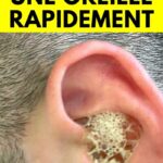 solutions naturelles oreille irritée
