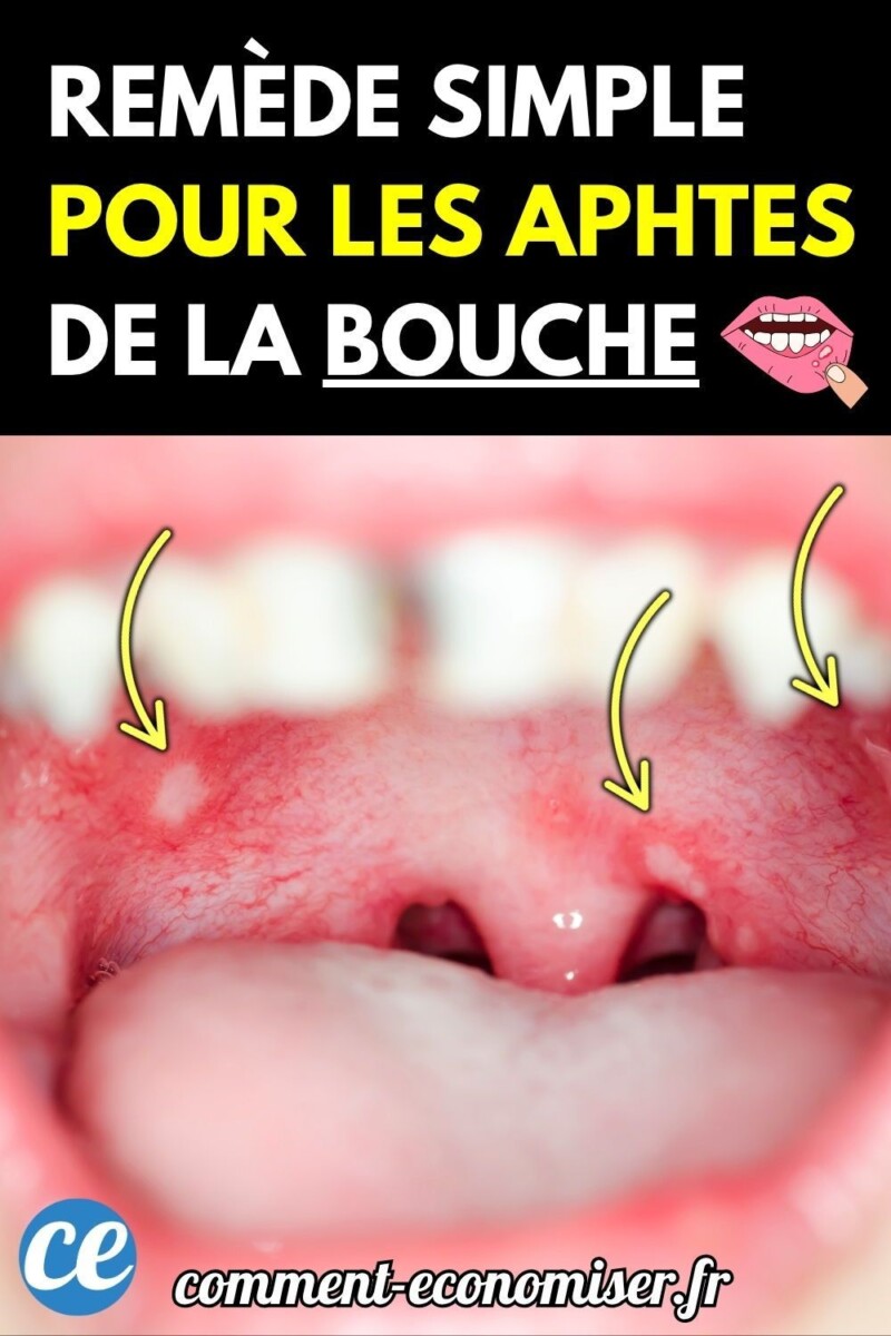 solution naturelle goût amer