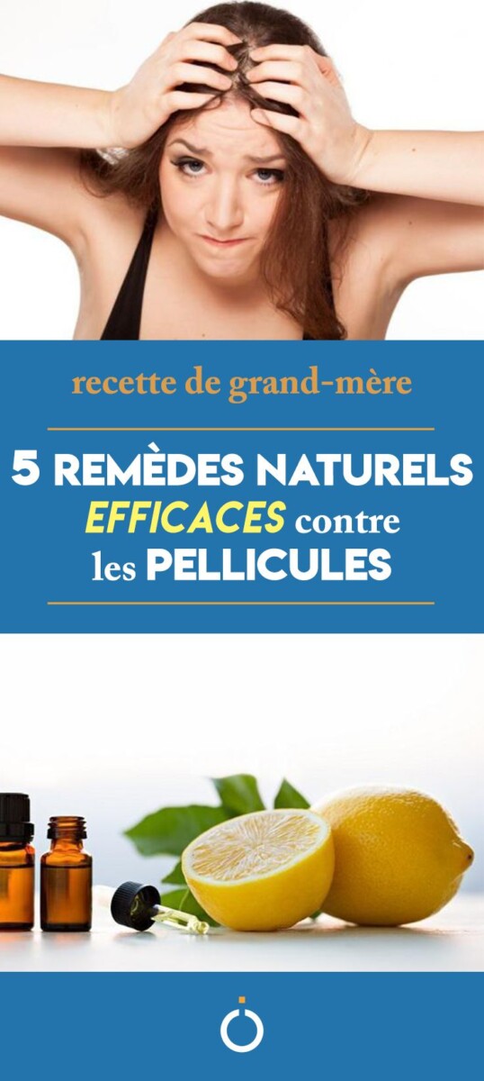 remède naturel contre pellicules