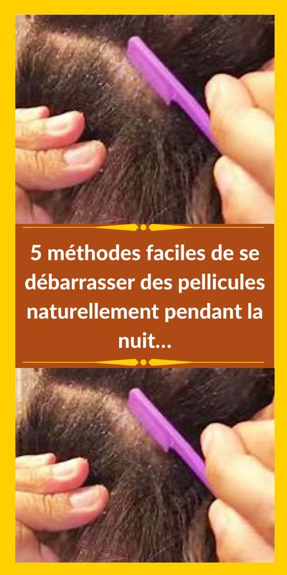 remède naturel contre pellicules