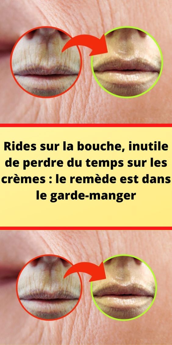 remède naturel pour bouche amère