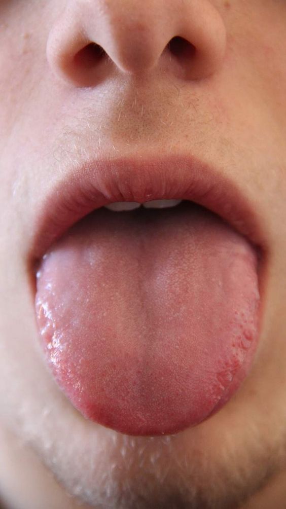 remède naturel pour bouche amère