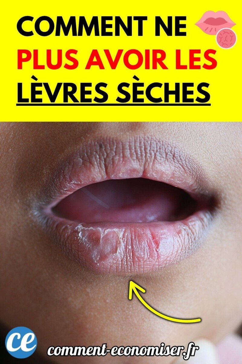 remède naturel pour bouche amère
