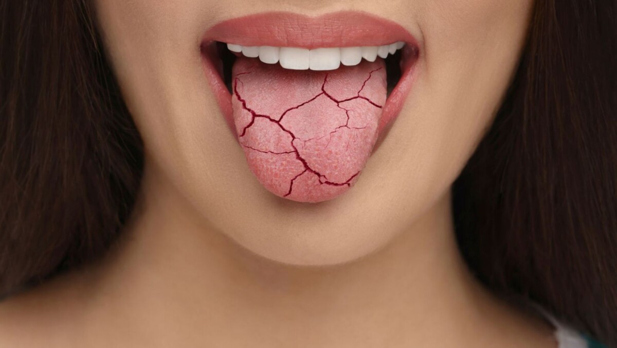 remède naturel pour bouche amère