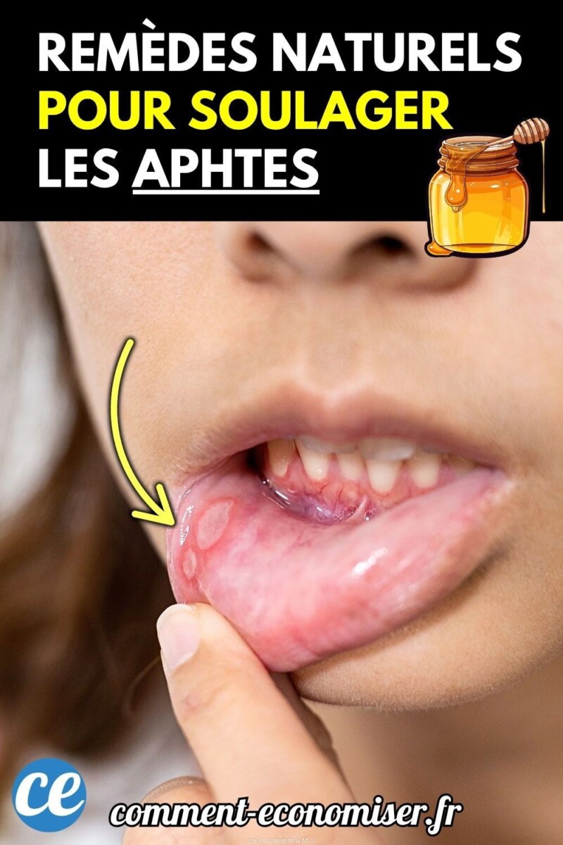 remède naturel pour bouche amère