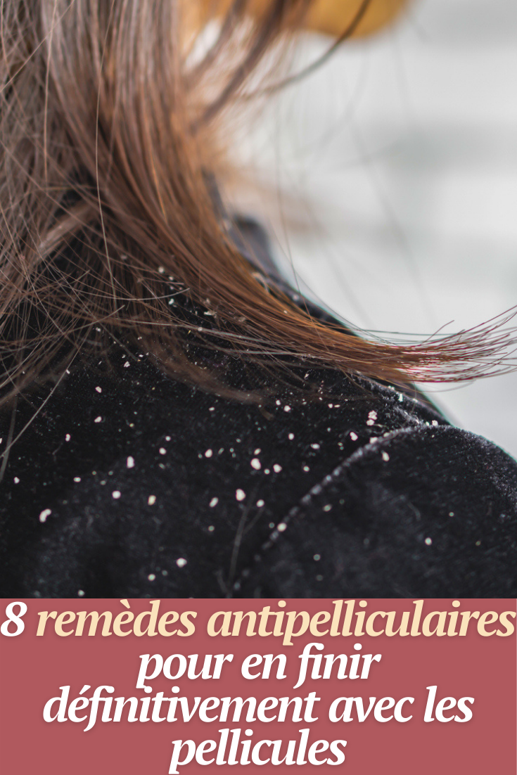 traitement naturel pellicules cheveux
