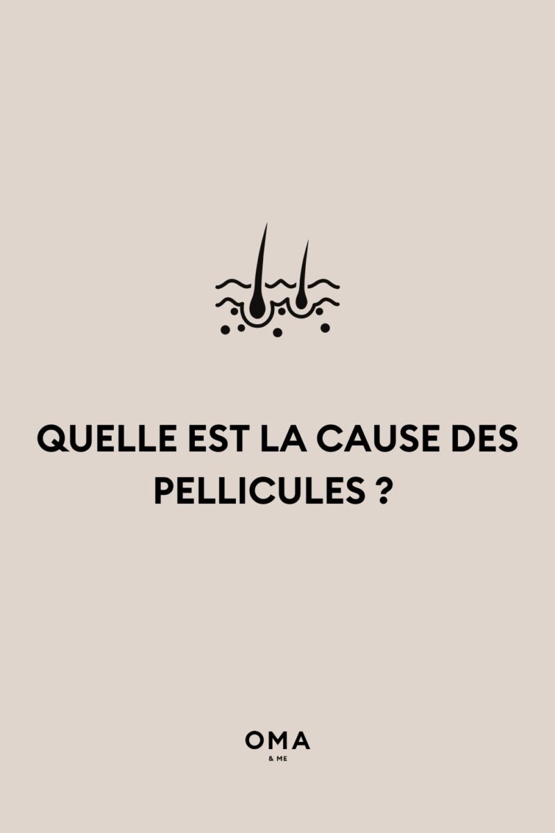 traitement naturel pellicules cheveux