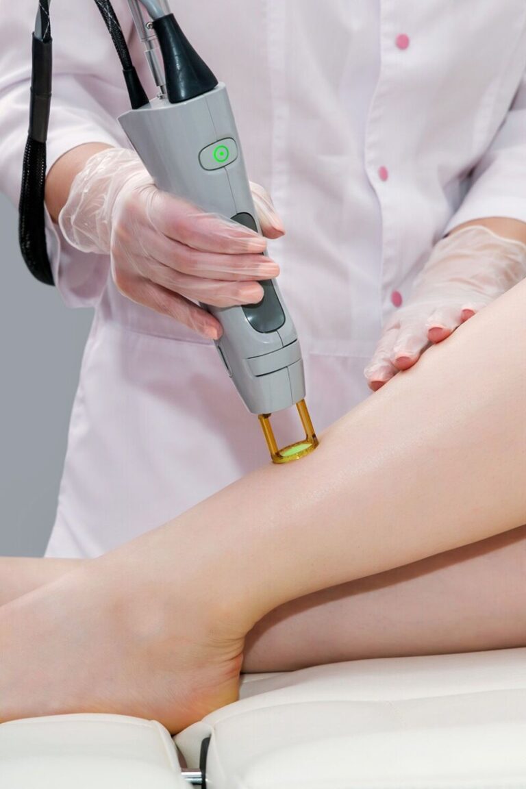 epilation laser attendre